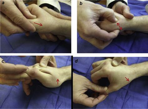 compression test by hand|thumb carpometacarpal joint test.